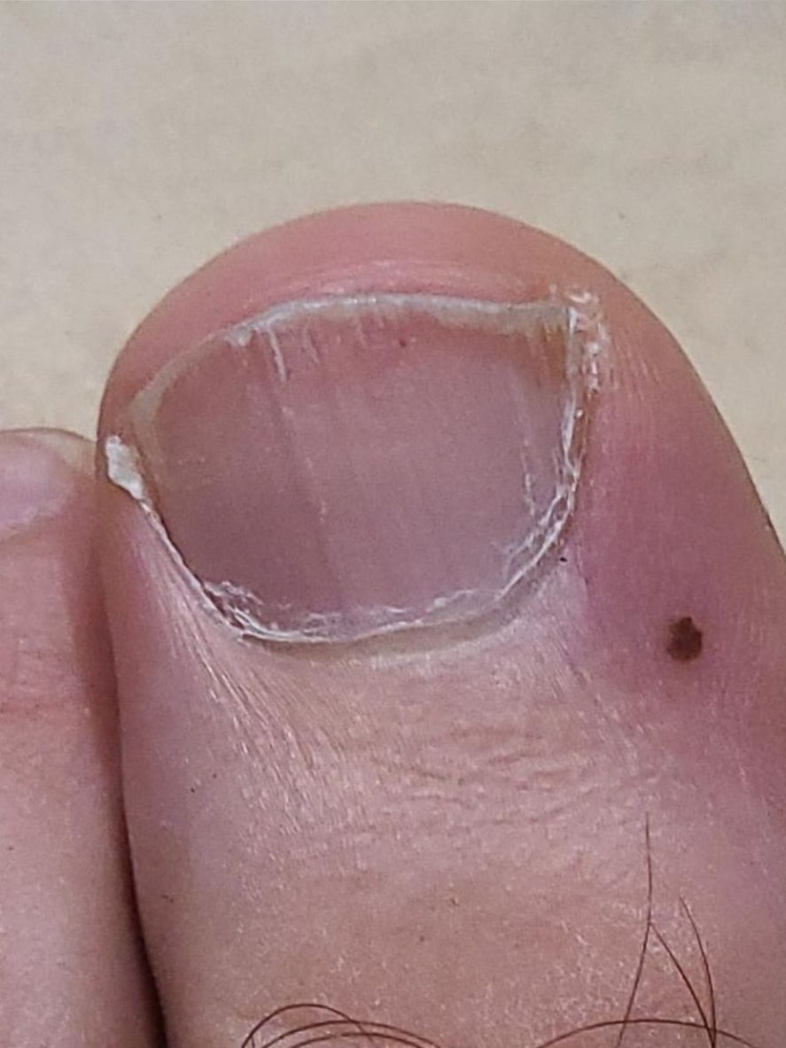 After view of a customer's nail-care progression