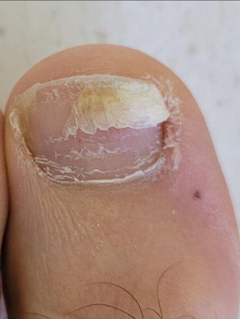 Progress view of a customer's nail-care progression